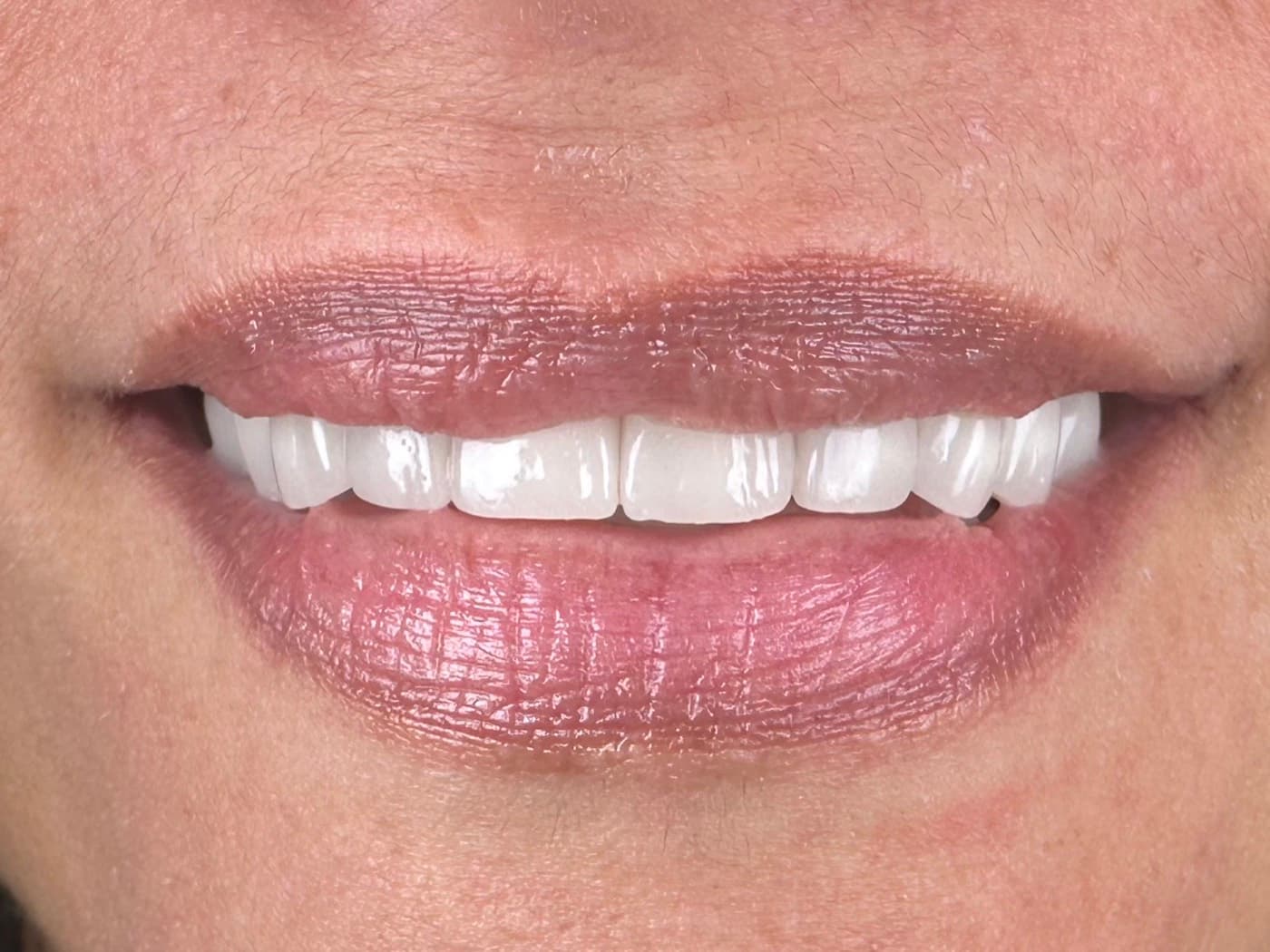 Case 01, after treatment