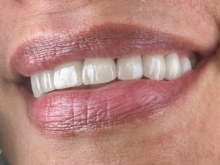 Case 01, after treatment, additional view 3