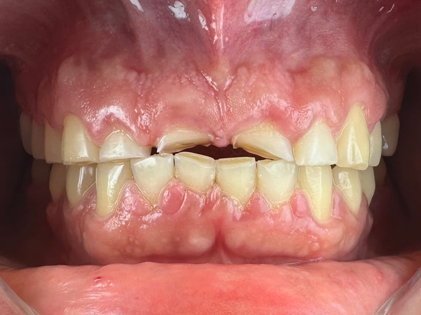 Case 02, before treatment