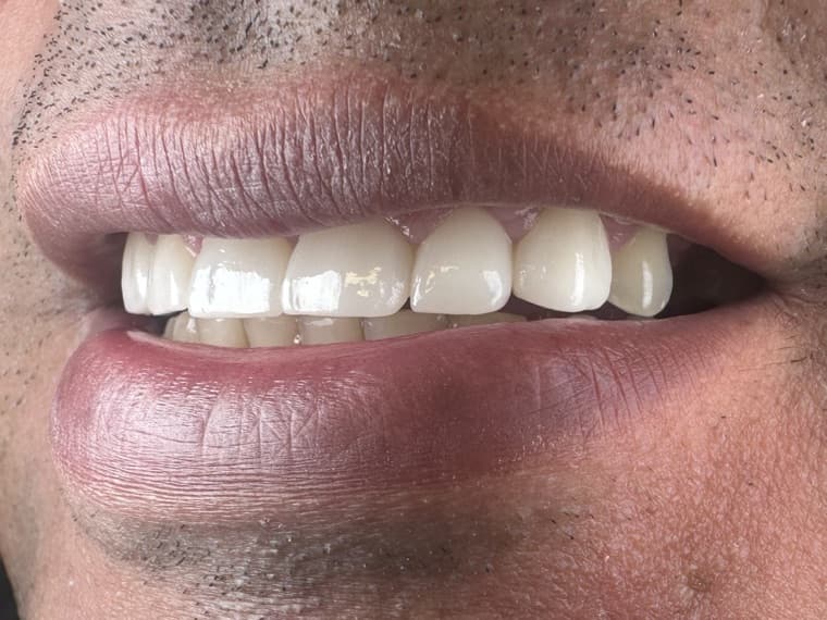 Case 02, after treatment, additional view 1