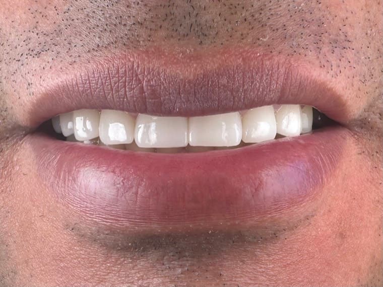 Case 02, after treatment, additional view 2