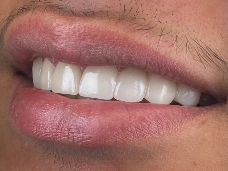 Case 03, after treatment, additional view 3