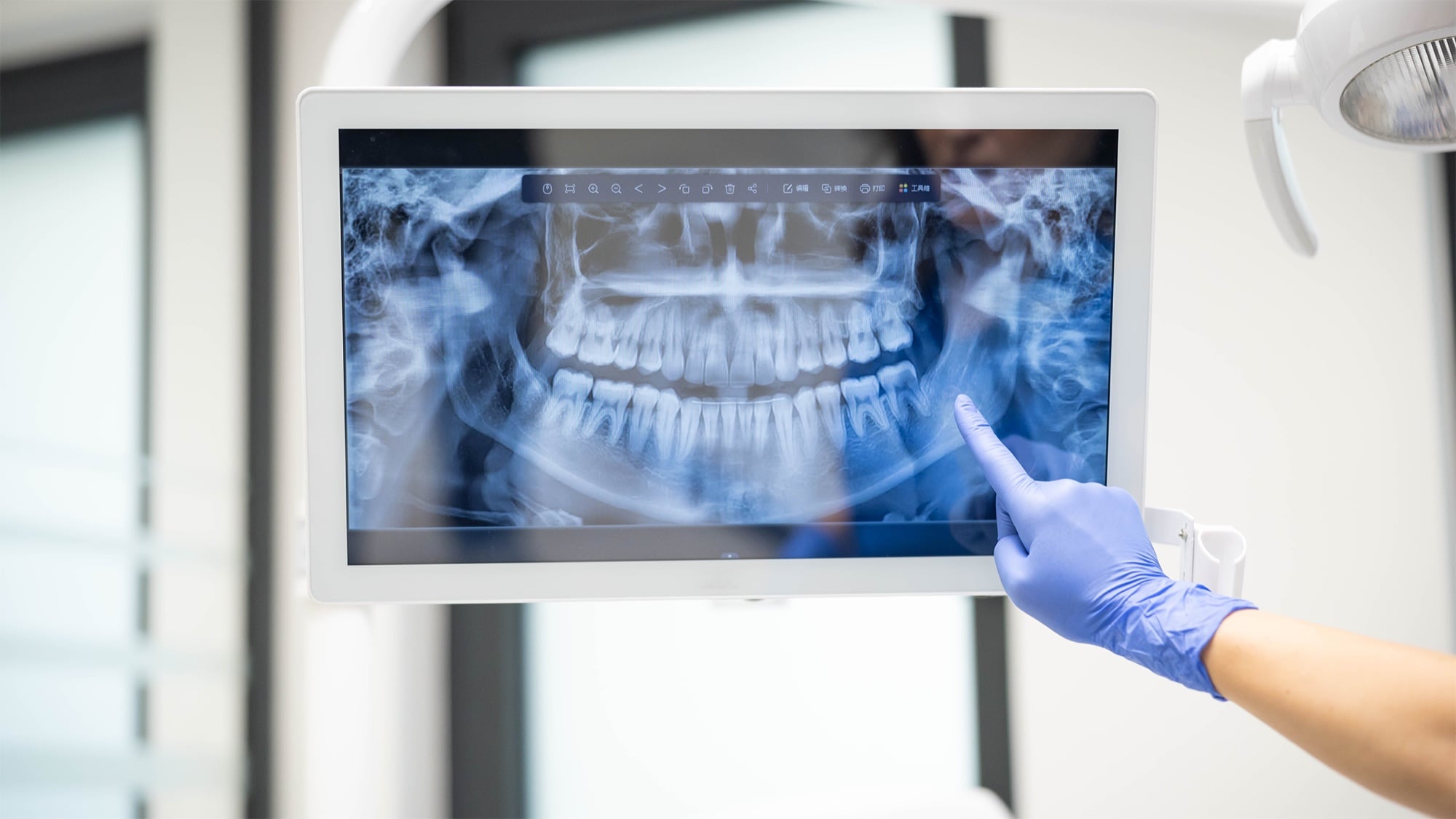 Panoramic dental X-ray displayed on a chairside monitor
