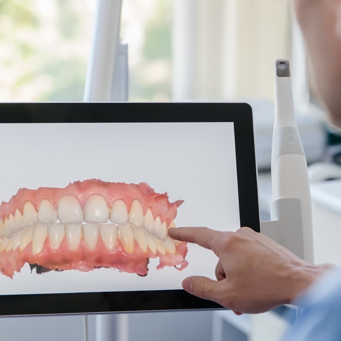 Dentist reviewing a digital impression on screen